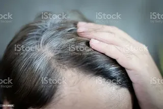 Safed balon ko kala kaise karen, bal kale karne ke natural tarike, white hair problem solution, bina dye balon ko kala karen,