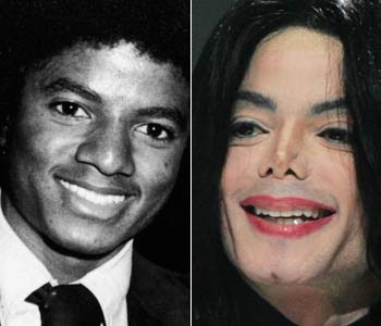 michael jackson before and after