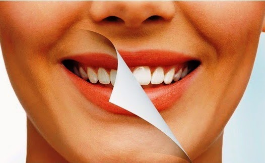 Cara Mudah Memutihkan Gigi Dengan Cara Alami