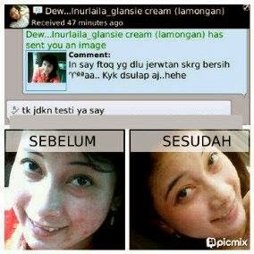 Testimoni Cream Dr Fajar Glansie Normal