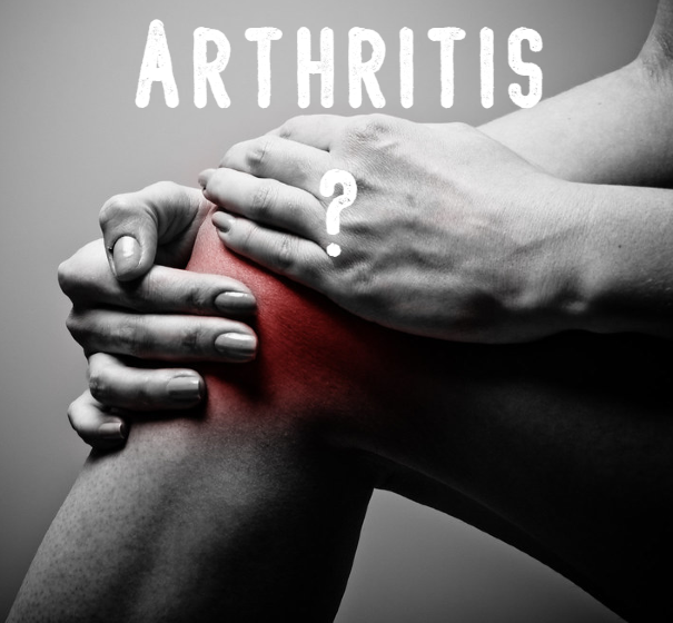 Arthritis. Is Arthritis serious? What is the best treatment for Arthritis?