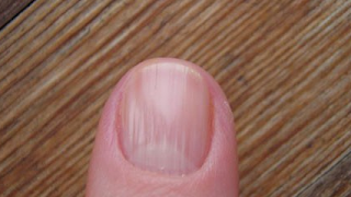 HOW TO DEAL WITH RIBBED AND CORRUGATED NAILS?