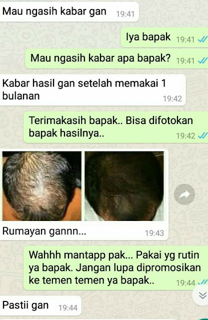 SOLUSI RAMBUT RONTOK DAN KEBOTAKAN