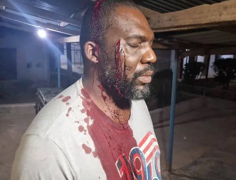 Soldiers Allegedly Beat Federal Lawmaker in Benue