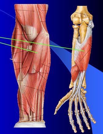 flexor pollicis longus. Flexor pollicis longus