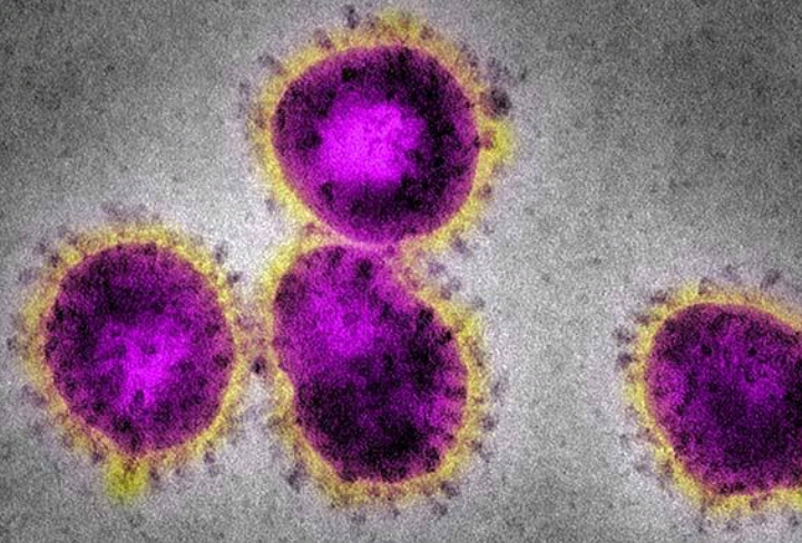 Iranian Knowledge-Based Company Exports Nano-Based Anti-Coronavirus System to 20 World States