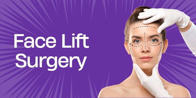 Face Lift Surgery