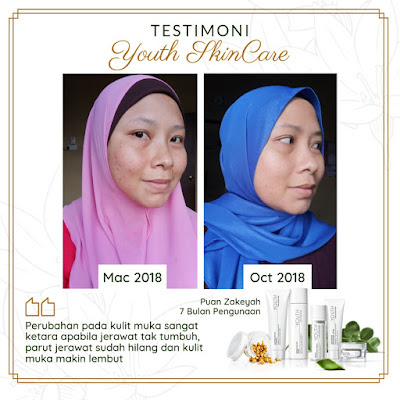 Testimoni Youth Skincare Untuk Jerawat