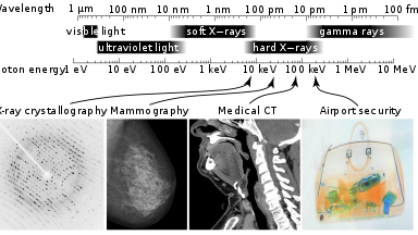 X-rays | Basic Concepts and Uses of X-rays