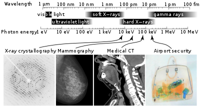 X-rays | Basic Concepts and Uses of X-rays