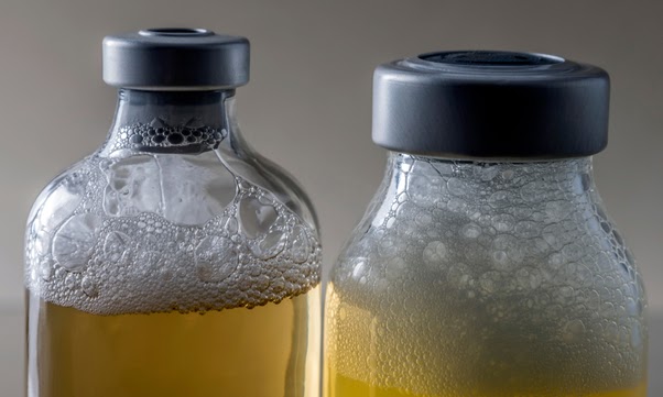 Pay Attention to Urine Colour, Foaming, Says Medical Expert