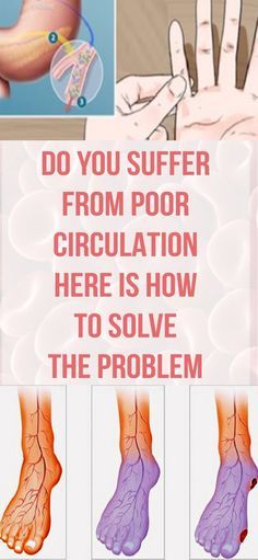 DO YOU SUFFER FROM POOR CIRCULATION? HERE’S HOW TO SOLVE THE PROBLEM!