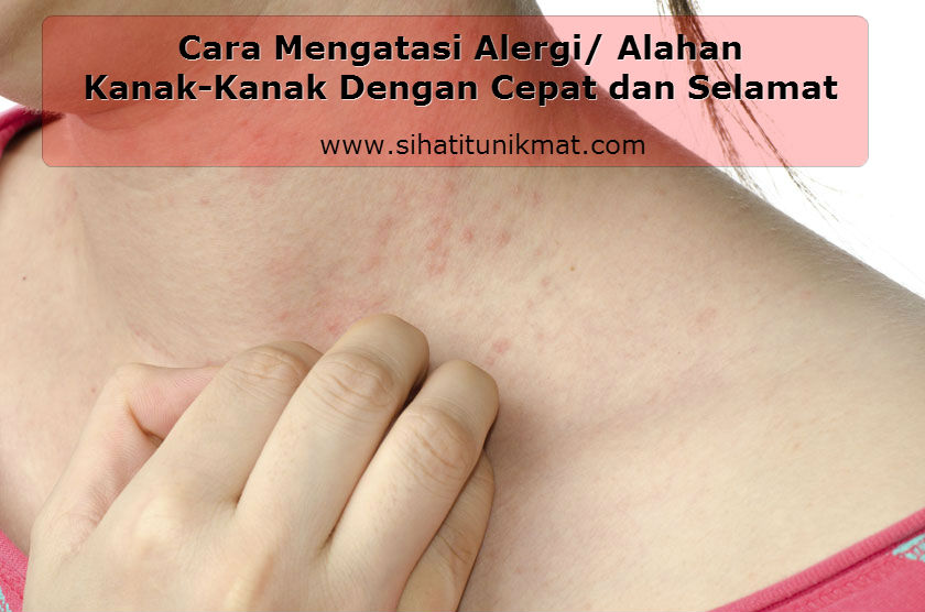 Cara Mengatasi Alergi/ Alahan Kanak-Kanak Dengan Cepat dan 