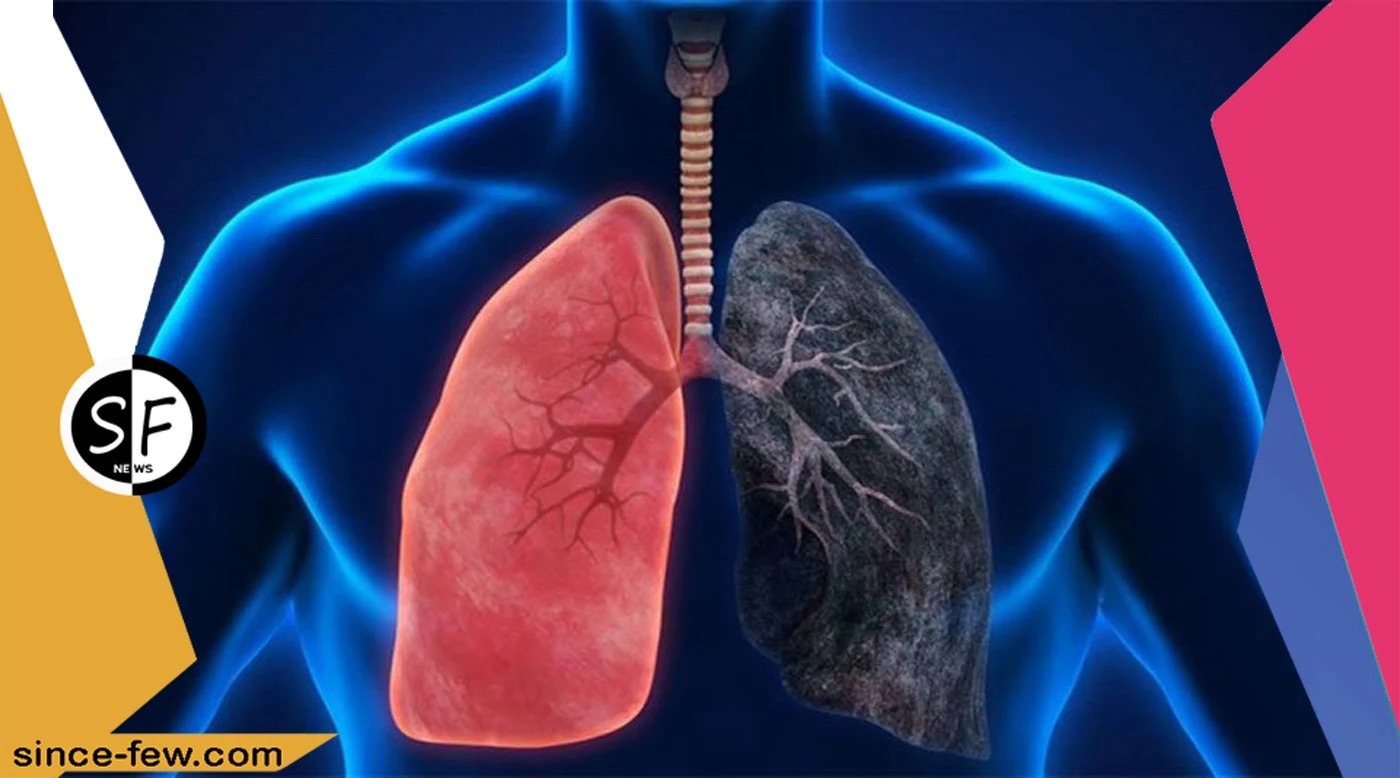 Learn How To Test For Lung Cancer At An Early Stage