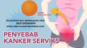 obat kanker herbal,obat kanker stadium 3,obat kanker stadium akhir,obat kanker payudara,obat kanker serviks,obat kanker otak,obat gejala kanker,cara mengobati kanker tanpa kemoterapi