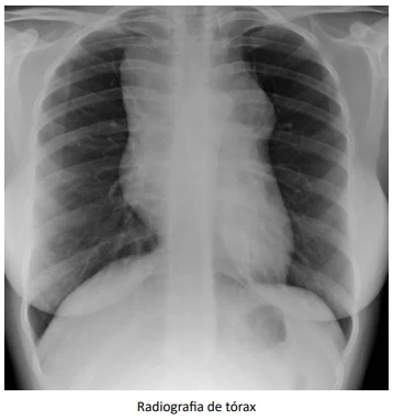 Foi realizada a radiografia de tórax, conforme exibido na imagem