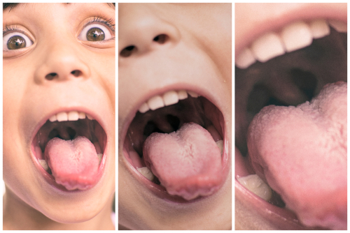 What is Oral Thrush in Babies and How Can I Prevent It