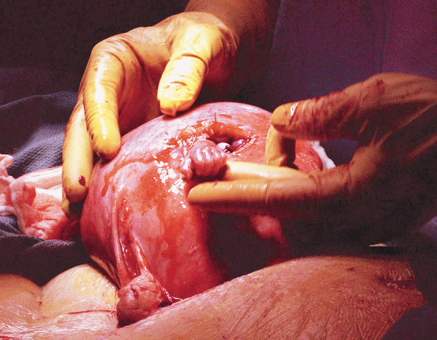 Surgeon And 21-week Old Fetus Shaking Hands