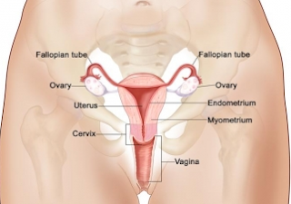 Definition Cervical cancer - symptoms cervical cancer