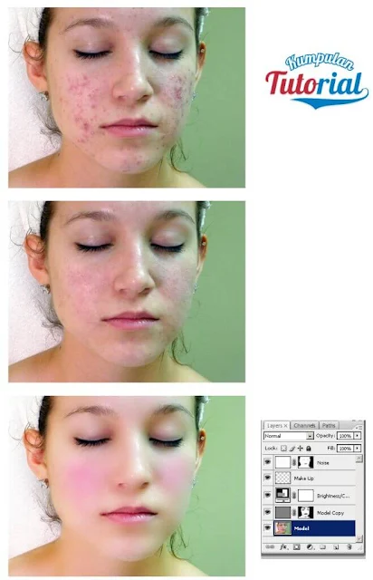 Cara Menghaluskan Wajah Berjerawat dengan Photoshop,  membersihkan muka dengan photoshop, cara mudah mengedit kulit wajah dengan photoshop, cara menghaluskan kulit wajah berjerawat di photoshop, mengedit foto muka berjerawat dengan photoshop cs3, cara edit wajah, memperbaiki kulit wajah model dengan photoshop.