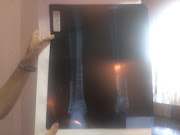 Xray of Monalisa's broken leg, which she did falling down the stairs three . (monalisa broken leg xray)