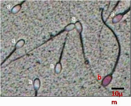 LAPORAN PRAKTIKUM EMBRIOLOGI SEDIAAN SPERMATOZOA 