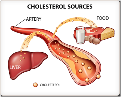 cholesterol