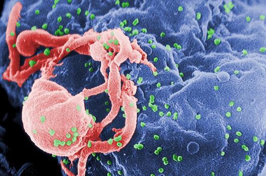 Big Step Ahead in Quest for HIV Vaccine