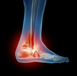 http://drsantpure.com/total-ankle-replacement.html