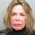 Elsa Patton Plastic Surgery Gone Wrong Before and After Botox Injections, Facelift and Eyelid