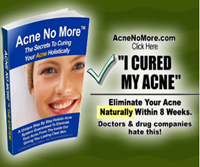 Acne Treatments Review