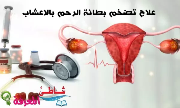 علاج تضخم بطانة الرحم بالاعشاب _ تعرف على اهم أسباب تضخم بطانة الرحم