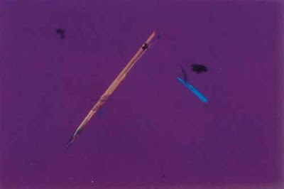 Uric acid, needle shape under polarized light with red compensator