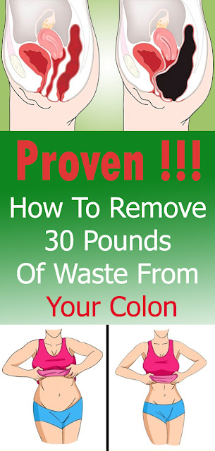 How To Remove 30 Pounds Of Waste From Your Colon