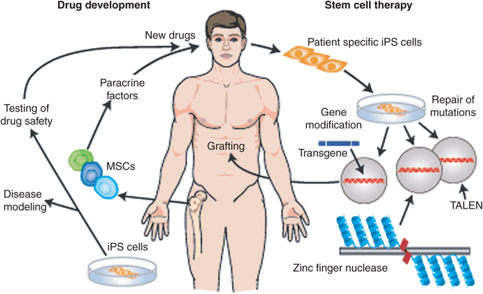 Stem Cell Therapy