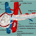 Acute pancreatitis