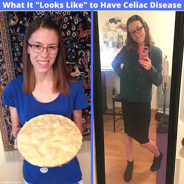 What really happens when you go #glutenfree after a #celiac diagnosis? Find out by reading this post on 7  common gluten free diet side effects!