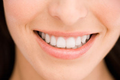 Bọc răng sứ zirconia cao cấp