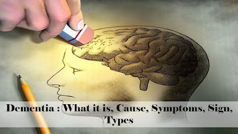 Dementia : Dementia symptoms, dementia causes, what dementia is dementia, dementia type