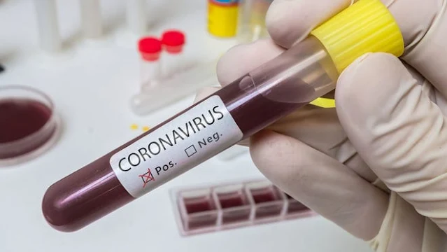 المهدية : تسجيل 13 إصابة جديدة بفيروس كورونا