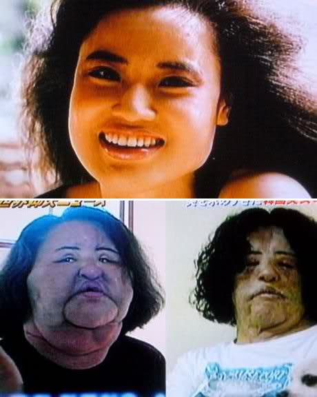 awful plastic surgery. of awful plastic surgery