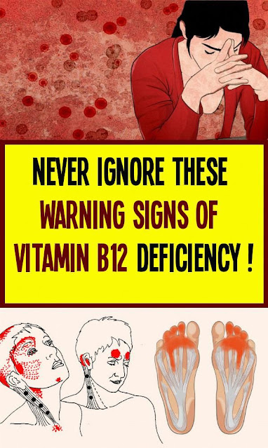 Never Ignore These Warning Signs Of Vitamin B12 Deficiency!