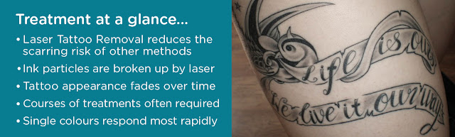 Tattoo Removal Treatments Dubai