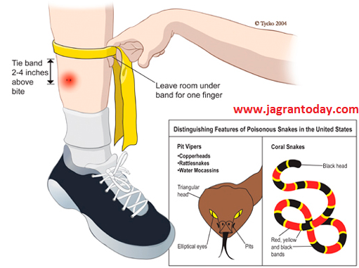 सर्प के काटने पर करें ये प्रयोग
