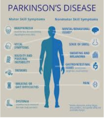 Parkinson's Disease Treatment A big breakthrough