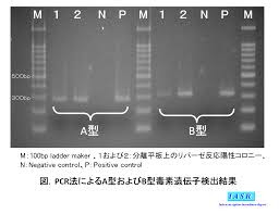 ボツリヌス菌 注射, ボツリヌス菌 注射 料金, ボツリヌス菌 注射 副作用, ボツリヌス注射 副作用, ボツリヌス菌 注射 脳卒中, ボツリヌス菌 注射 効果, ボツリヌス菌注射 食いしばり, ボツリヌス菌 注射 美容, ボツリヌス注射 エラ, ボツリヌス注射 脇汗, ボツリヌス療法 リハビリ,  ボツリヌス菌, ボツリヌス菌 注射, ボツリヌス菌からしれんこん, ボツリヌス菌 ボトックス, ボツリヌス菌 注射 副作用, ボツリヌス 最強, ボツリヌス毒素 作用, ボツリヌス菌 致死量, ボツリヌス菌 潜伏期間, ボツリヌス菌 h型, ボツリヌス菌 もやしもん, 