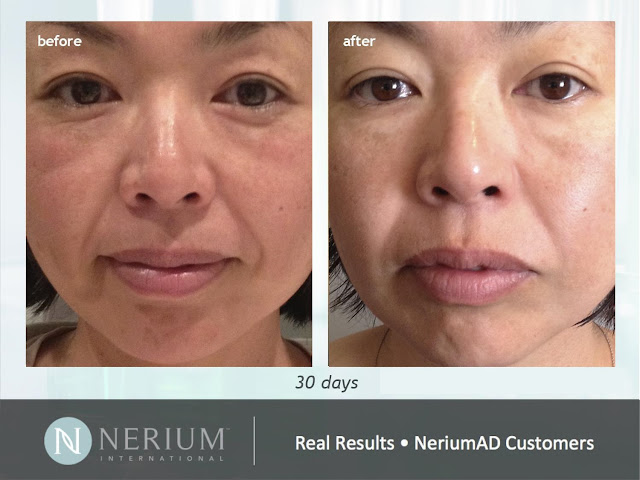 http://eliloz.nerium.com