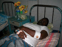 Ruhunu Campus Students Union Leader Attacked