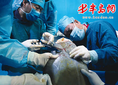 Doctors Doing Surgery on Ill Whale