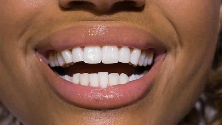How to Clean Teeth and Whiten with Turmeric